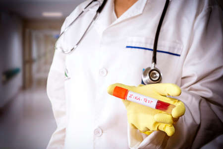 Tests For Research Of Zica virus ZIKV