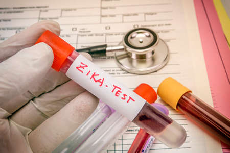 Tests For Research Of Zica virus ZIKV