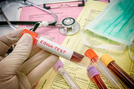 Tests For Research Of Ebola virusの写真素材