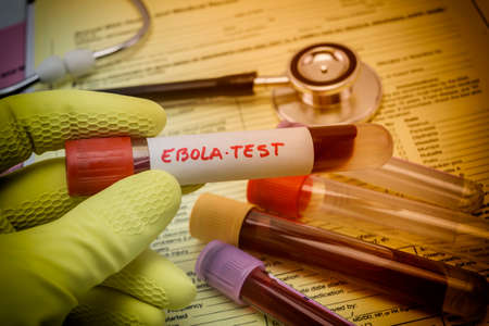 Tests For Research Of Ebola virus, Doctor holding a vial of vaccine virus Ebolaの写真素材