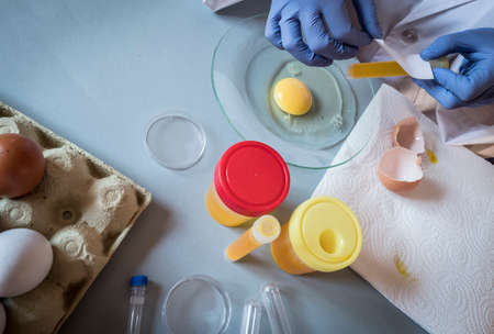 Scientist at laboratory investigates the crisis caused by the fraud of the contaminated eggs with fipronil in Spainの写真素材