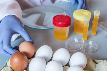 Scientist at laboratory investigates the crisis caused by the fraud of the contaminated eggs with fipronil in Spainの写真素材