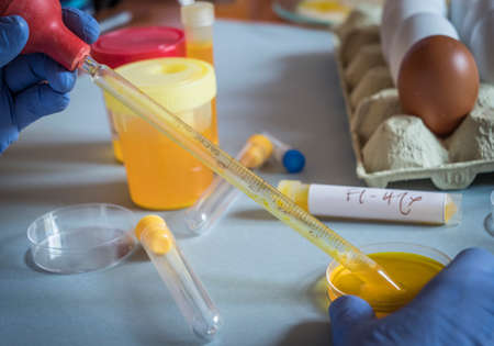 Scientist at laboratory investigates the crisis caused by the fraud of the contaminated eggs with fipronil in Spainの写真素材