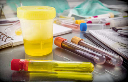 Doctor working with urine samples in a clinical laboratory