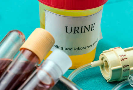 Urine and blood samples at a hospital table, conceptual image