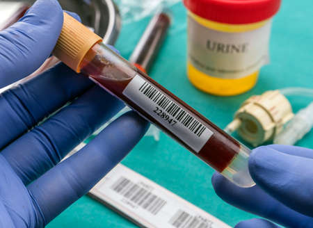 Doctor holds blood sample at a hospital table, conceptual image