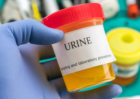 Doctor working with urine samples in a clinical laboratoryの写真素材