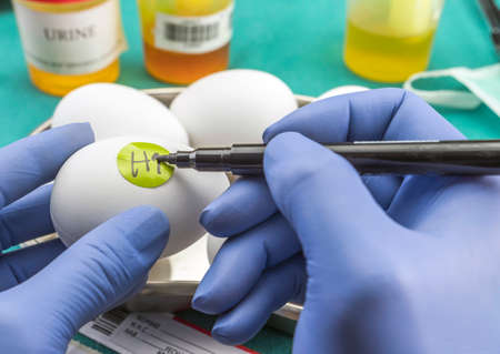 Scientific brand with label eggs in poor condition to examine in the laboratory, clinical, conceptual imageの写真素材