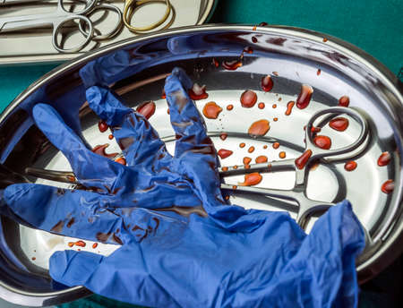 Gloves blue and scissors stained with blood on a tray in an operating theater, conceptual imageの写真素材
