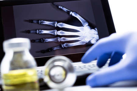 Hand radiography in hospital, conceptual imageの写真素材