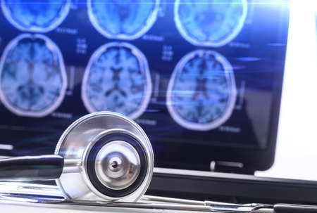Stethoscope next to computer with X-rays of the brain, conceptual imageの写真素材