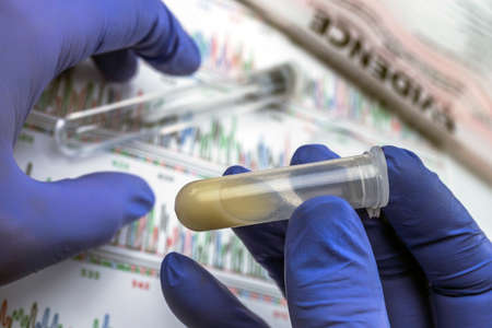 Expert police examines semen for DNA evidence, conceptual imageの写真素材