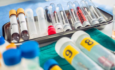 blood sample from glass bottle in Criminalistic Lab, conceptual image