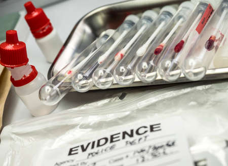 Different samples hair and blood to analyze in the laboratory scientific, conceptual image