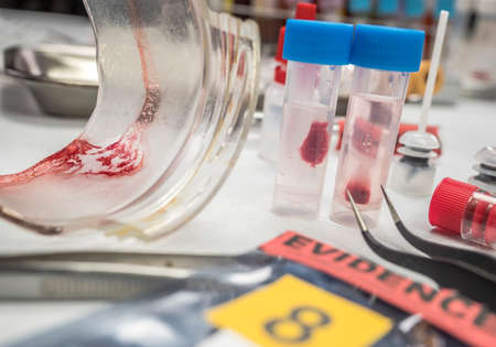 Swabs with blood sample to be analyzed in the laboratory, conceptual image