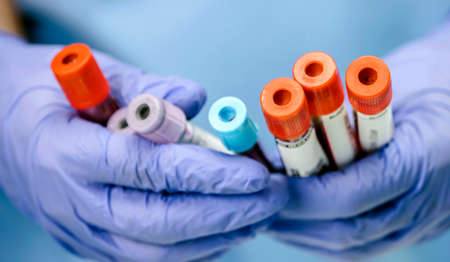 Several blood samples along with needle, conceptual image