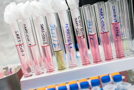 Vials with samples of SARS-COV-1 prepared cold in a laboratory, epiedomological study on Sars-CoV-2...