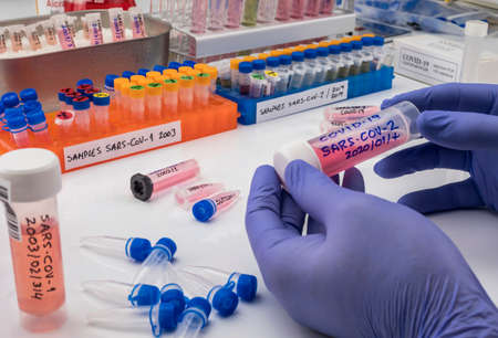 Vials with samples of SARS-COV-1 prepared cold in a laboratory, epiedomological study on Sars-CoV-2...