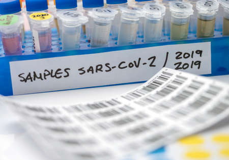 Vials with samples of SARS-COV-2 Covid-19 in a research laboratory, conceptual imageの写真素材