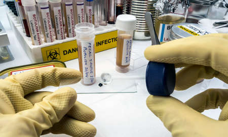 Experienced laboratory scientist analyzing a fecal sample, botulism infection in sick people,...
