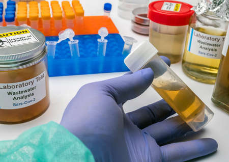 Scientific analysis of wastewater sample in laboratory, investigation of possible contamination by...