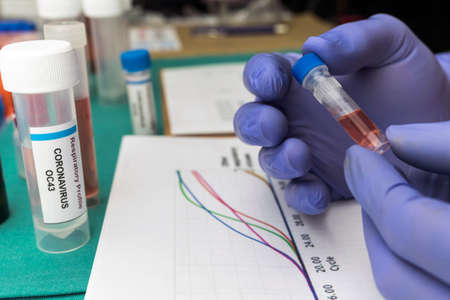Scientist studies the curves of the Covic-19 pandemic and the dna of an infected person, holding a...