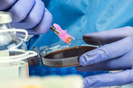 Nurse prepares blood culture in a petri dish prepared for experiment, conceptual imageの写真素材