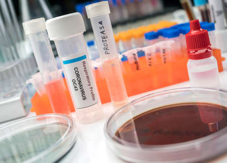 Vials with samples of SARS-COV-2 Covid-19 in a research laboratory, conceptual image