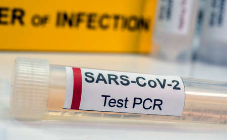 Vial pcr of SarsCov2 coronavirus, conceptual imageの写真素材