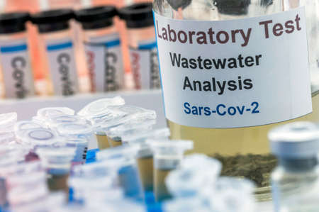 Wastewater samples, analysis of sars-cov-2 virus in patients infected by human coronavirus 229E,...