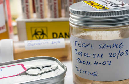 Fecal sample of a person infected with botulism, infection in tin cans in poor condition, conceptual...