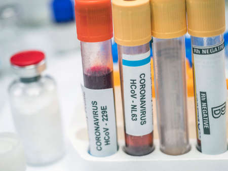 Selection of blood samples to analyze patients infected with sars-cov-2, conceptual imageの写真素材