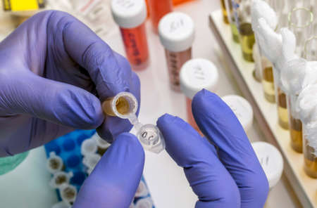 Scientist Investigates Medical Treatment for Covid-19 Coronavirus in Hospital, Spainの写真素材