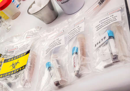 Blood samples from sars-cov2 infected people, preaparatives for Rt-PCR, conceptual image