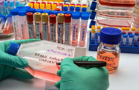 Scientist writes in a vial new variant of covid-19 virus from Brazil detected in Minnesota, concept...