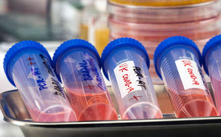 Several vials positive for covid-19 infection of the new variant in the UK, conceptual image.の写真素材
