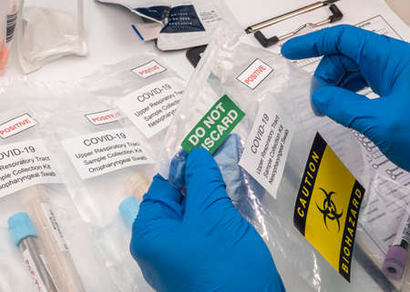 Nurse analyses positive PCR tests of covid-19 in a hospital laboratory, conceptual image