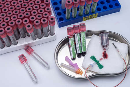Sample vials of blood from possible Ebola patients infected with new Zaire strain of Ebola, concept...