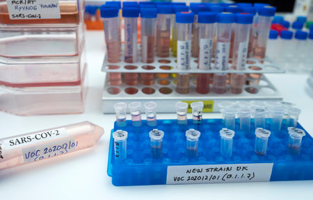 Laboratory research new strain of British sars-cov-2 scientifically named VOC 202012/01 (B.1.1.7),...