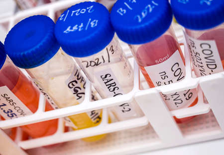 Laboratory research new strain of South Africa sars-cov-2 scientifically known as 20H/501Y.V2 or B.1.351), conceptual pictureの写真素材