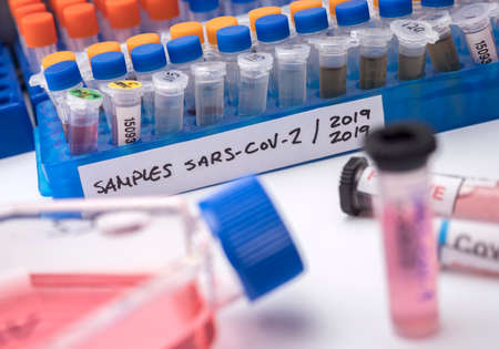 Vials with samples of SARS-COV-2 Covid-19 in a research laboratory, conceptual imageの写真素材