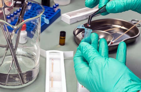 Police expert extracts traces of blood in a swab for analysis in the laboratory scientist