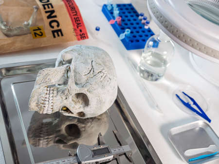 Human skull of a murdered adult in forensic lab, conceptual imageの写真素材