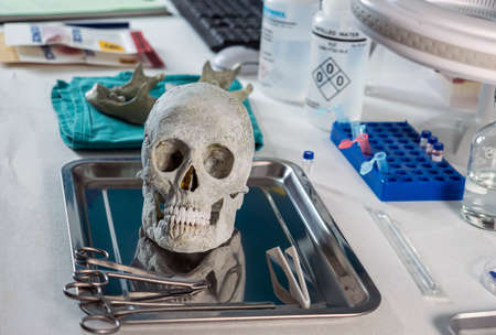 Human skull of a murdered adult in forensic lab, conceptual imageの写真素材