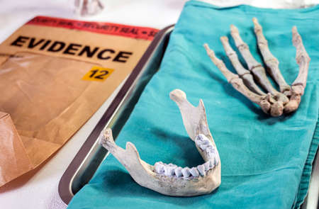 Human lower jaw and right hand in forensic laboratory murder investigation, concept image