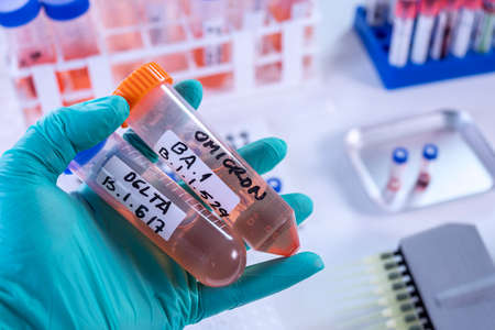 Scientist in laboratory holding vials for sars-cov2 Delta and Omicron variant research, concept...