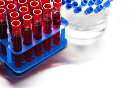 Laboratory tests - blood in glass tubes in a medical laboratoryの写真素材