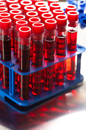 Laboratory tests - blood in glass tubes in a medical laboratoryの写真素材