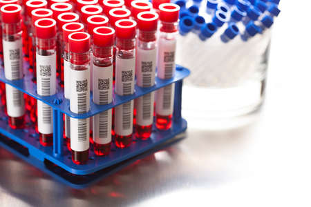 Laboratory tests - blood in glass tubes in a medical laboratoryの写真素材