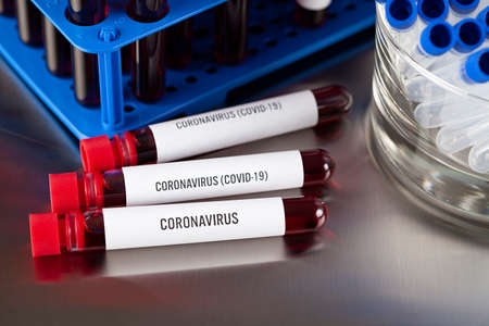 Laboratory tests - blood in glass tubes in a medical laboratoryの写真素材